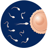 Poor-Sperm-Motility.png