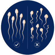 Weak-Sperm-Quality.png